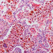 Udoskonalone czerwone krwinki