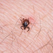 Borelioza – rozpoznanie i leczenie